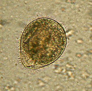 Balantidium este cel mai mare parazit protozoar