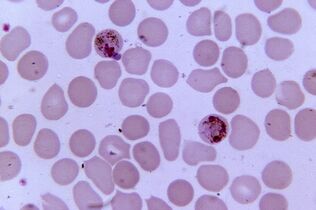 Plasmodium de malarie