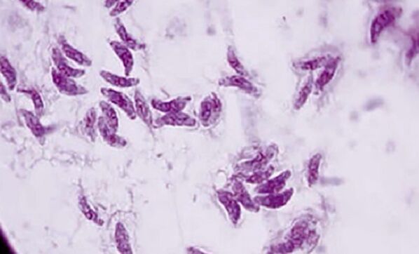 protozoar parazit toxoplasma gondii agentul cauzal al toxoplasmozei